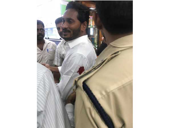 రక్తపు గాయంతోనే హైదరాబాద్‌కు జగన్