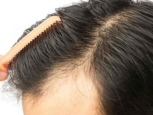 శ్రవణ్ ఎలా మృతి చెందాడు..?