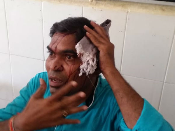 RTC bus accident ,30 passengers wereinjured in Bhupalapalli district 