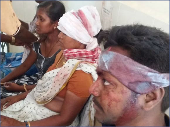 RTC bus accident ,30 passengers wereinjured in Bhupalapalli district 
