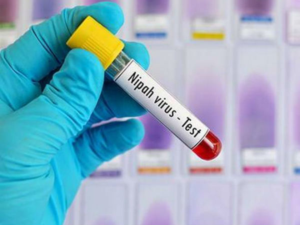 17మందిని బలిగొన్న నిఫా 