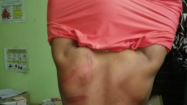 పోడు భూముల రచ్చ.. అటవీ అధికారులపై మరో దాడి