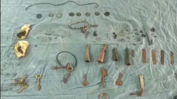 ఆపరేషన్ నిర్వహించిన వైద్యులకు షాక్