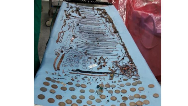 మతిస్థిమితం లేకే బంగారు వస్తువులను మింగేసిందన్న తల్లి