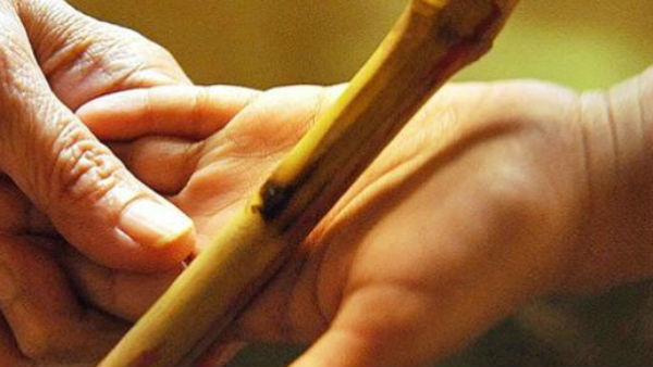 విరిగిన వేలు ..