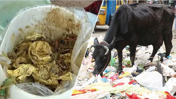  52 కిలోల ప్లాస్టిక్ వ్యర్థంను గుర్తించిన వైద్యులు