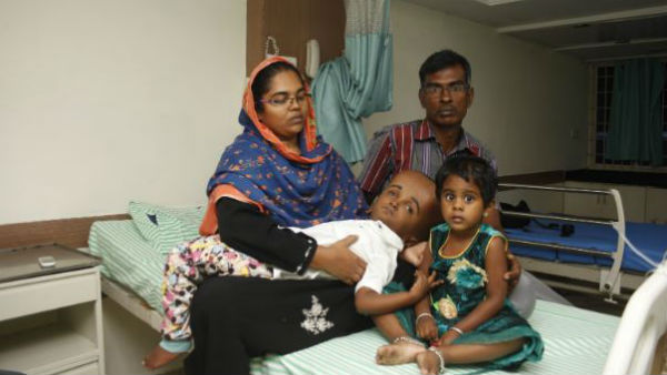 Hilals rare disease makes him look starkly different from other 7 year olds 