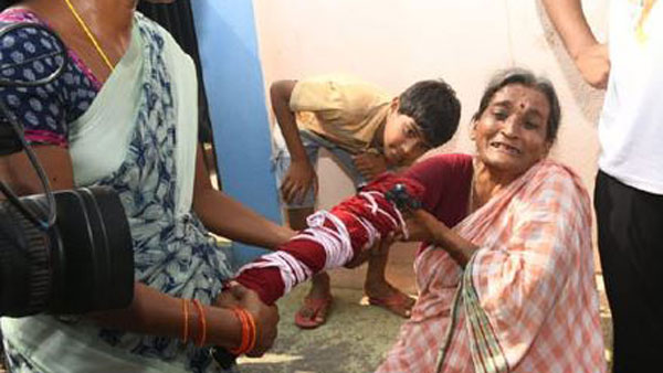 పోలీసుల దాడిలో మహిళ చేయి విరిగింది..