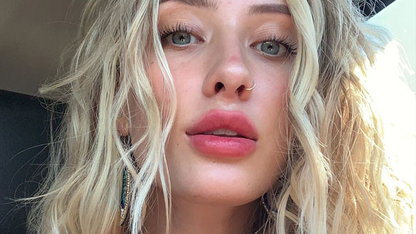 సోషల్ మీడియా ప్రకటనకు విశేష స్పందన