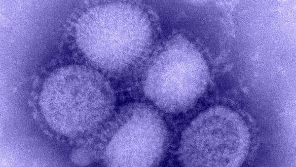 స్వైన్ ఫ్లూ పట్ల అప్రమత్తత అవసరం