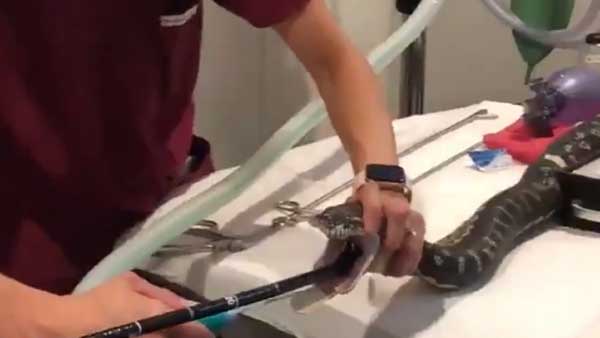 ఆపరేషన్ లేకుండా..