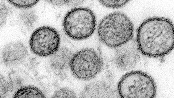 ఇండియాలోనూ మరణాలు..