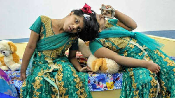 అవిభక్త కవలలు వీణావాణీలకు వేర్వేరు హాల్టిక్కెట్లు అవిభక్త కవలలు వీణావాణీలకు వేర్వేరు హాల్టిక్కెట్లు