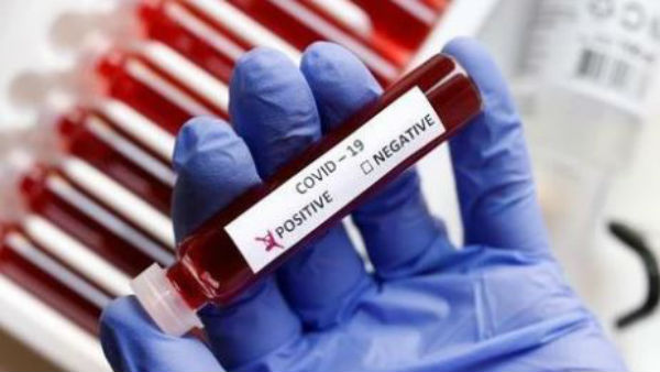 టెస్టింగ్ ఎలా ఉంటుంది..