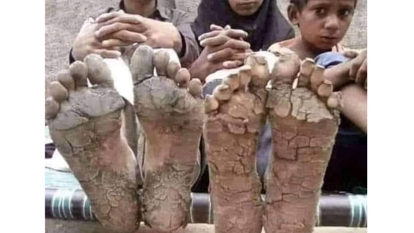 ఛిద్రమైన బతుకులు.. 