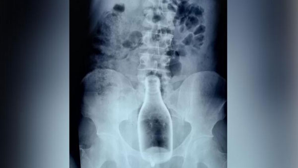 నాగూరు యువకుడు..