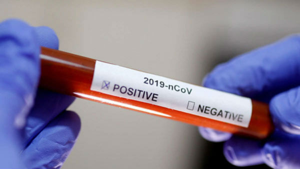 కరోనా బాధితుల పాలిట ప్మాస్మానే సంజీవని.. సీపీకి అభినందనలు కరోనా బాధితుల పాలిట ప్మాస్మానే సంజీవని.. సీపీకి అభినందనలు