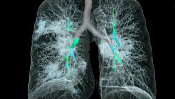  ఆస్ట్రియా వైద్యులు ఏం చెబుతున్నారు..?