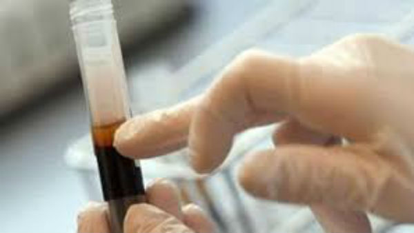  ప్లాస్మా థెరపీతో కరోనా తగ్గదు..