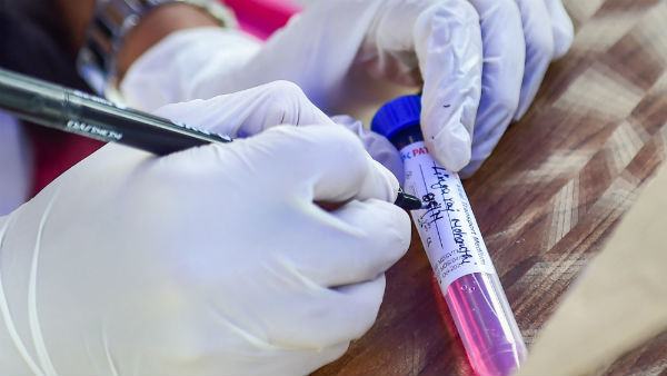 డోసుల్లో తేడాలకు అర్థమేంటి?