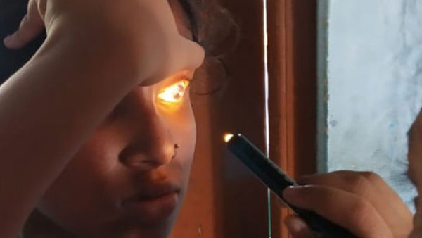 చూపు కోల్పోయి.. మజ్జ రోగం.. చూపు కోల్పోయి.. మజ్జ రోగం..