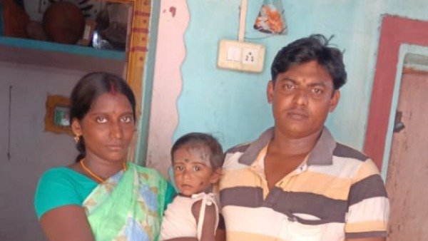 Help to save 1 year old Nindra Mokshita from heart problem