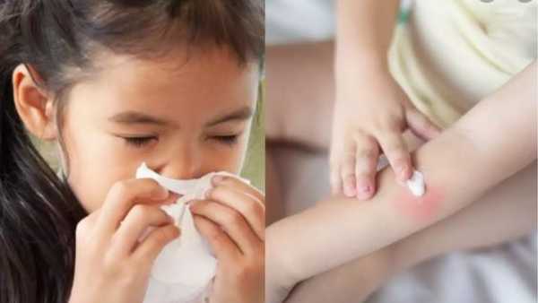పిల్లల్లో సాధారణ కరోనా లక్షణాలు
