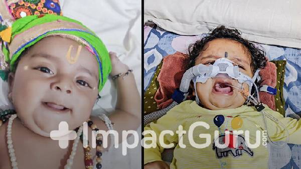 Baby Janish Needs A Wonder Drug To Survive SMA, Please Help 