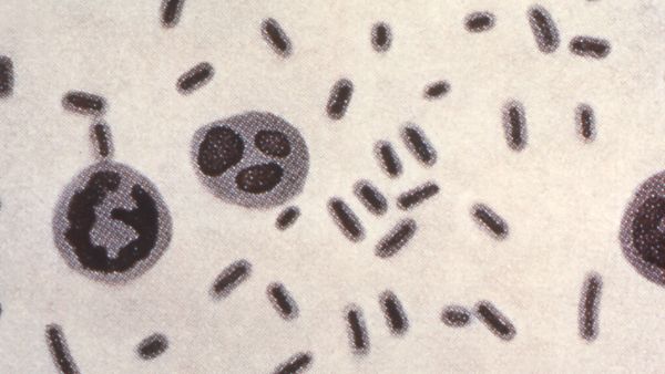  కరోనా పరిస్ధితుల్లో వ్యాప్తికి అవకాశం