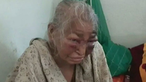 BJP workers mother Shova Majumdar who was allegedly beaten by TMC dies
