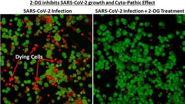 ఆక్సిజన్ అవసరం ఉండదు.. ఆక్సిజన్ అవసరం ఉండదు..