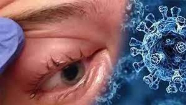 మరో ఇద్దరు చిన్నారుల కళ్లు తొలగింపు మరో ఇద్దరు చిన్నారుల కళ్లు తొలగింపు