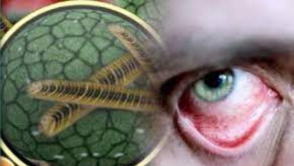 ముగ్గురిలో ఒకరికి డయాబెటీస్... ముగ్గురిలో ఒకరికి డయాబెటీస్...