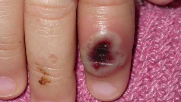 మొదట 1970లో బయటపడ్డ వైరస్...