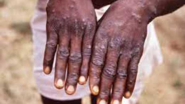 ఎలా వ్యాపిస్తుంది...