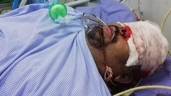 చికిత్సకు సహకరించని అవయవాలు చికిత్సకు సహకరించని అవయవాలు