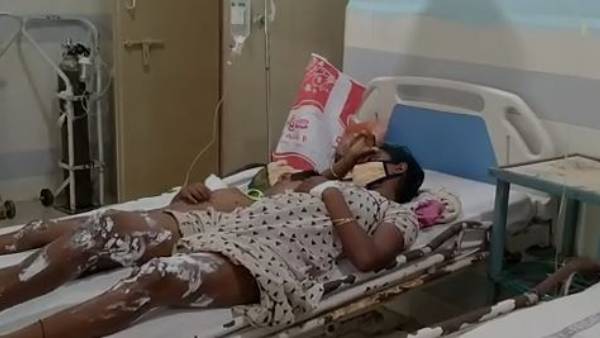 ప్రేయసిపై అనుమానం .. పెళ్లి ఇష్టం లేక పెట్రోల్ పోసి నిప్పంటించిన యువకుడు ప్రేయసిపై అనుమానం .. పెళ్లి ఇష్టం లేక పెట్రోల్ పోసి నిప్పంటించిన యువకుడు