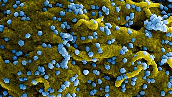 ఎబోలా రకానికి చెందిన వైరస్..