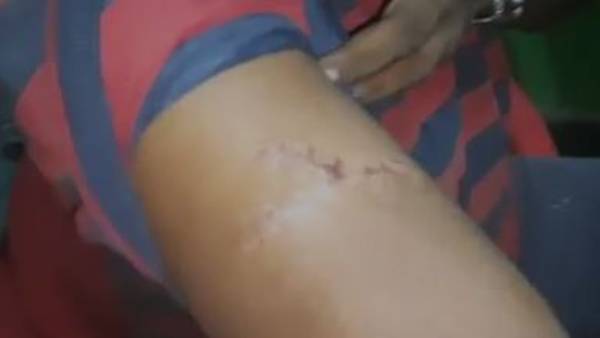 తమపై హత్యాయత్నం జరిగినా ఇప్పటివరకు చర్యలు లేవన్న కుటుంబం