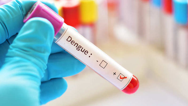  డెంగ్యూ కేసుల తీవ్రత తగ్గుతుందని అంచనా.. అన్ని ఆస్పత్రులలోనూ వైద్యం 