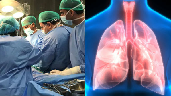 రోజూ 10 లీటర్ల ఆక్సిజన్తో.. రోజూ 10 లీటర్ల ఆక్సిజన్తో..