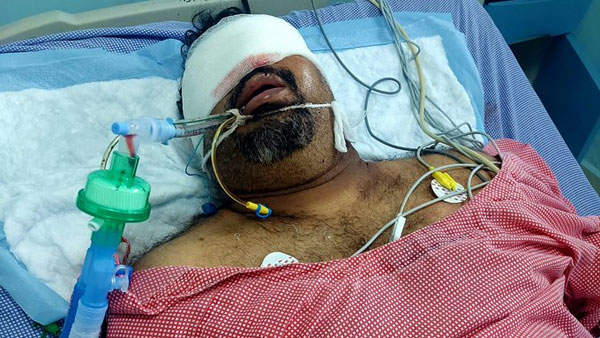 కత్తి మహేష్ చికిత్స కోసం..