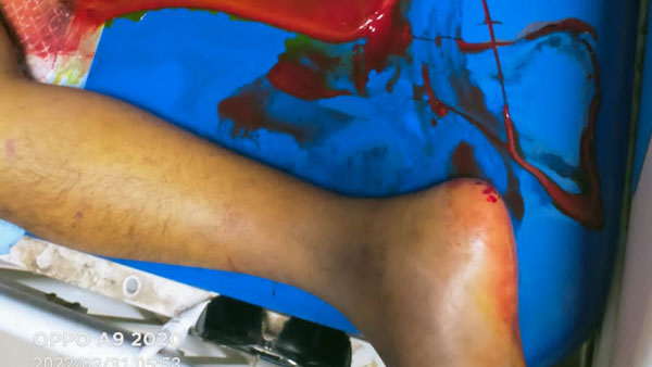 ఎలుకల బెడదతో రోగుల ప్రాణాలకు హాని .. ఆస్పత్రి సిబ్బంది పట్టింపేది