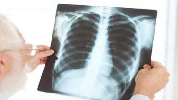 రూ.2 వేలతో ఎక్స్ రే మిషన్