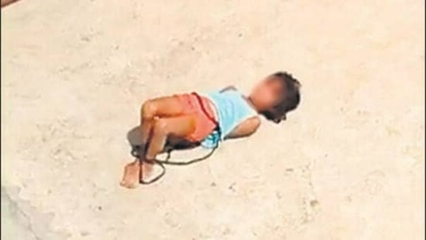 హోం వర్క్ చెయ్యలేదని బాలికపై తల్లి అమానుషం హోం వర్క్ చెయ్యలేదని బాలికపై తల్లి అమానుషం