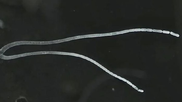 750 మైక్రోమీటర్ల పొడవుతో.. 