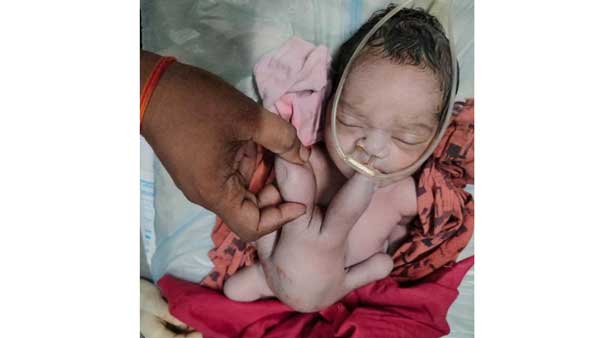 దేవతా ప్రతిరూపంగా చెప్పుకుంటున్న స్థానికులు