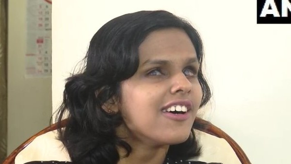 మైక్రోఫ్తాల్మియా.. మైక్రోఫ్తాల్మియా..