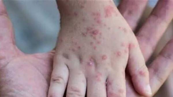 దుబాయ్ నుంచి వచ్చిన చిన్నారి