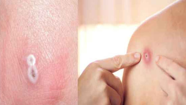 ఢిల్లీలో ఇదివరకే..